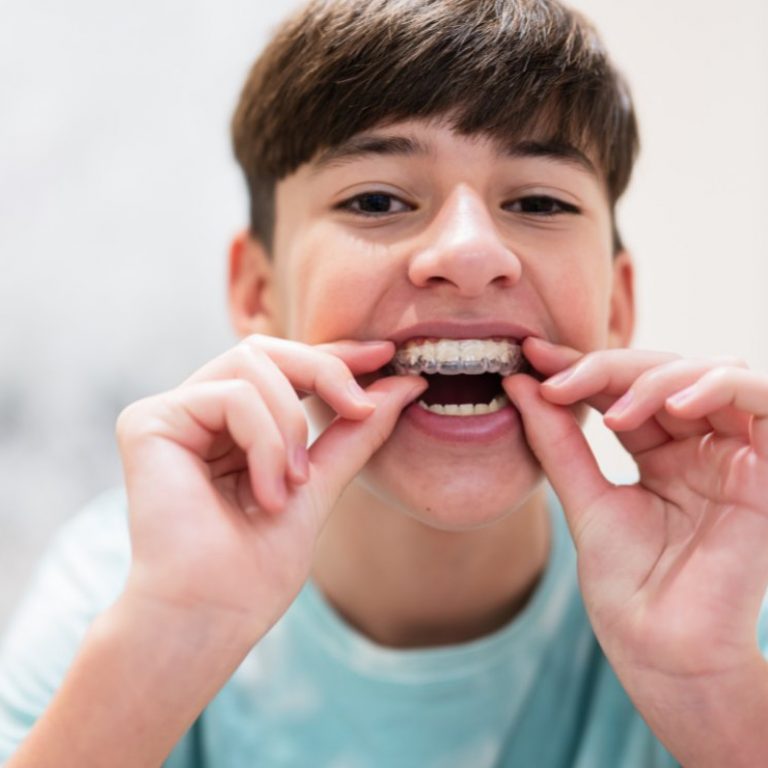 Ortodoncia Infantil y Adolescentes en Valladolid