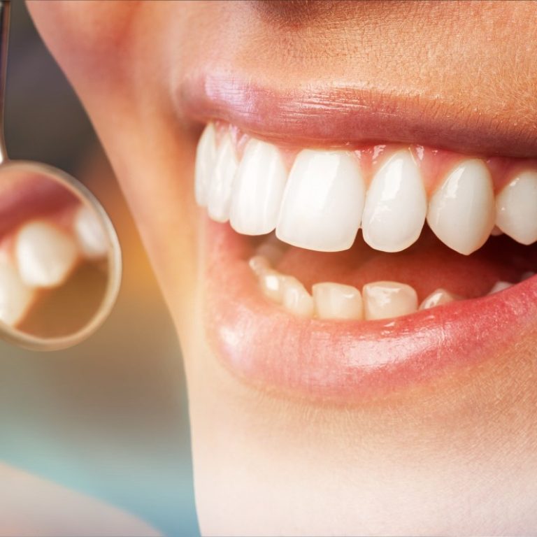 Periodoncia en Murcia Ortoperio